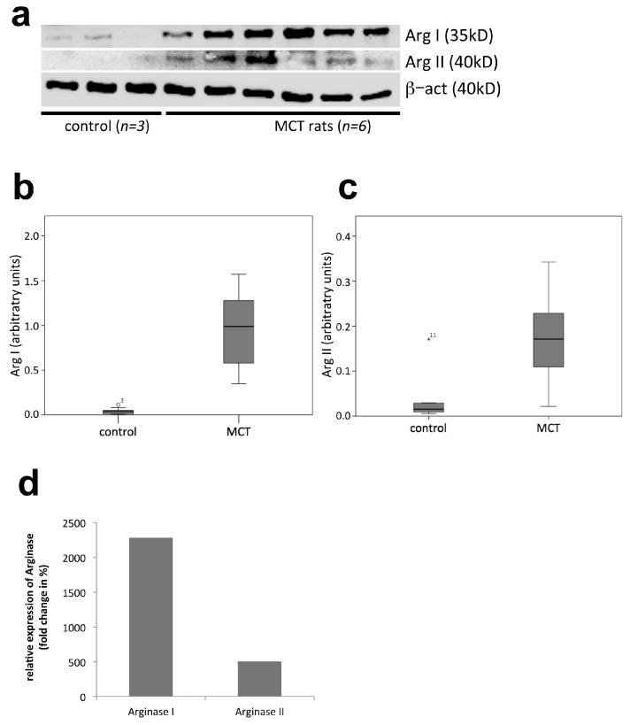 https://cdn.ncbi.nlm.nih.gov/pmc/blobs/6b49/5578001/c96fe64f69c2/ijms-18-01609-g004.jpg