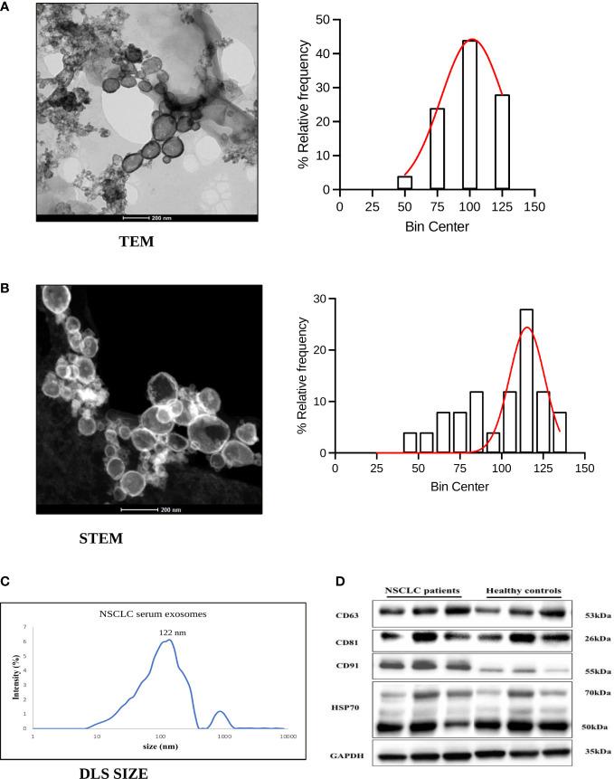 https://cdn.ncbi.nlm.nih.gov/pmc/blobs/6b4a/9890181/d7554b8bc48c/fimmu-13-1097117-g001.jpg