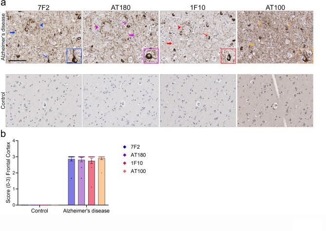 https://cdn.ncbi.nlm.nih.gov/pmc/blobs/6b59/12141574/723fbf844603/41598_2025_4291_Fig4_HTML.jpg