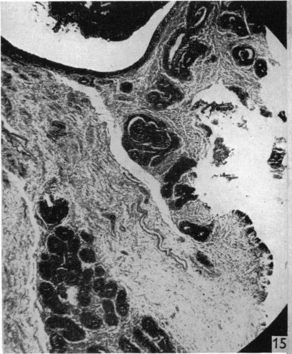 https://cdn.ncbi.nlm.nih.gov/pmc/blobs/6b59/1244890/52fc2b9009a9/janat00451-0161-b.jpg