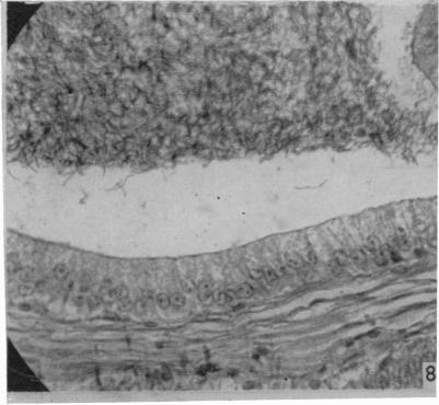 https://cdn.ncbi.nlm.nih.gov/pmc/blobs/6b59/1244890/cf04b9c02b28/janat00451-0159-e.jpg