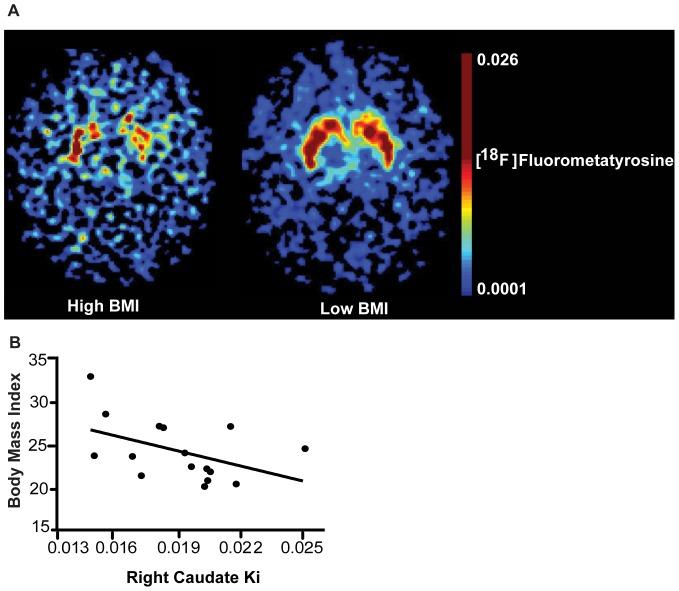 https://cdn.ncbi.nlm.nih.gov/pmc/blobs/6b61/4012945/b488c2d6a70c/pone.0096319.g002.jpg