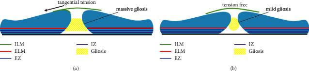 https://cdn.ncbi.nlm.nih.gov/pmc/blobs/6b63/10361828/b5f7d9b5e663/JOPH2023-7640476.003.jpg