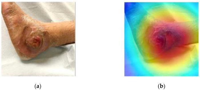 https://cdn.ncbi.nlm.nih.gov/pmc/blobs/6b66/8870992/514fcad3e160/diagnostics-12-00237-g004.jpg