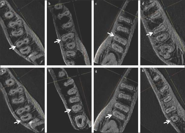 https://cdn.ncbi.nlm.nih.gov/pmc/blobs/6b67/8056815/b8caa369a7d8/EEJ-6-72-g002.jpg