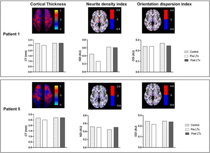 https://cdn.ncbi.nlm.nih.gov/pmc/blobs/6b6b/11706762/24061cb36804/JIMD-48-0-g003.jpg