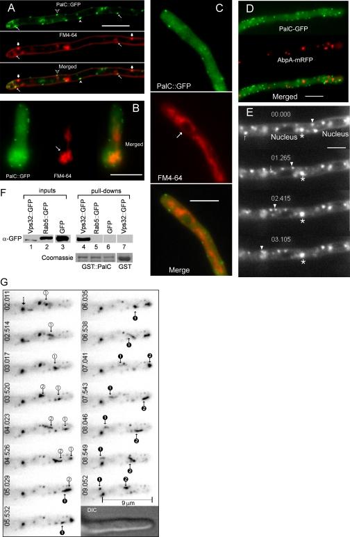 https://cdn.ncbi.nlm.nih.gov/pmc/blobs/6b6b/2171039/ade382173fe4/tra0008-1346-f9.jpg