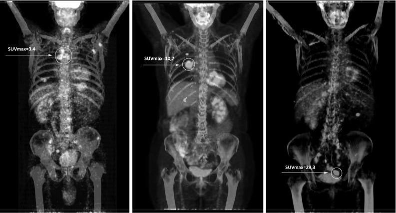 https://cdn.ncbi.nlm.nih.gov/pmc/blobs/6b70/6394561/193e980c4986/10238_2018_539_Fig1_HTML.jpg