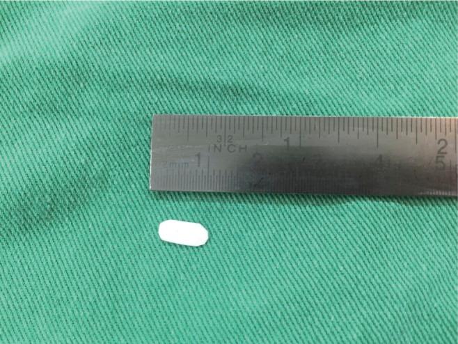 https://cdn.ncbi.nlm.nih.gov/pmc/blobs/6b72/5439340/a3f4aaa412b5/bmdcn-7-6-fig3.jpg