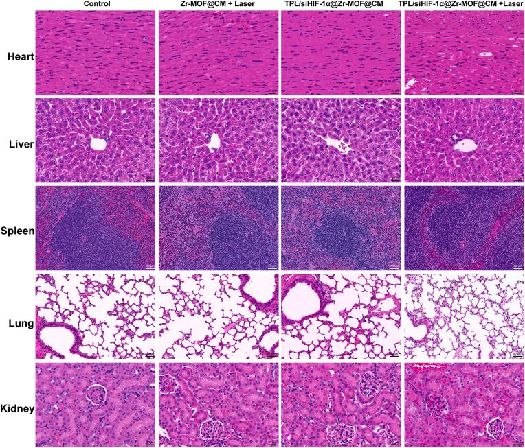 https://cdn.ncbi.nlm.nih.gov/pmc/blobs/6b73/12398845/d1f1e7c74fa7/gr6.jpg