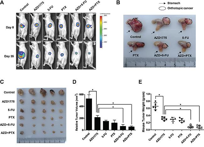 https://cdn.ncbi.nlm.nih.gov/pmc/blobs/6b75/5226556/28981f9afbc1/oncotarget-07-49902-g007.jpg