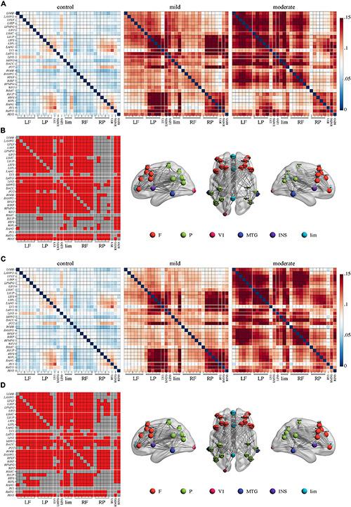 https://cdn.ncbi.nlm.nih.gov/pmc/blobs/6b75/8293898/09cb7de4ed8c/fnagi-13-679585-g002.jpg