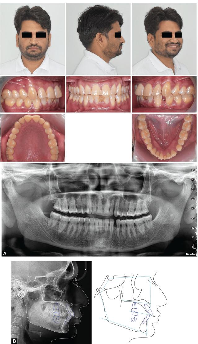 https://cdn.ncbi.nlm.nih.gov/pmc/blobs/6b78/10373786/7b6d52b3bc67/ijcpd-16-388-g002.jpg
