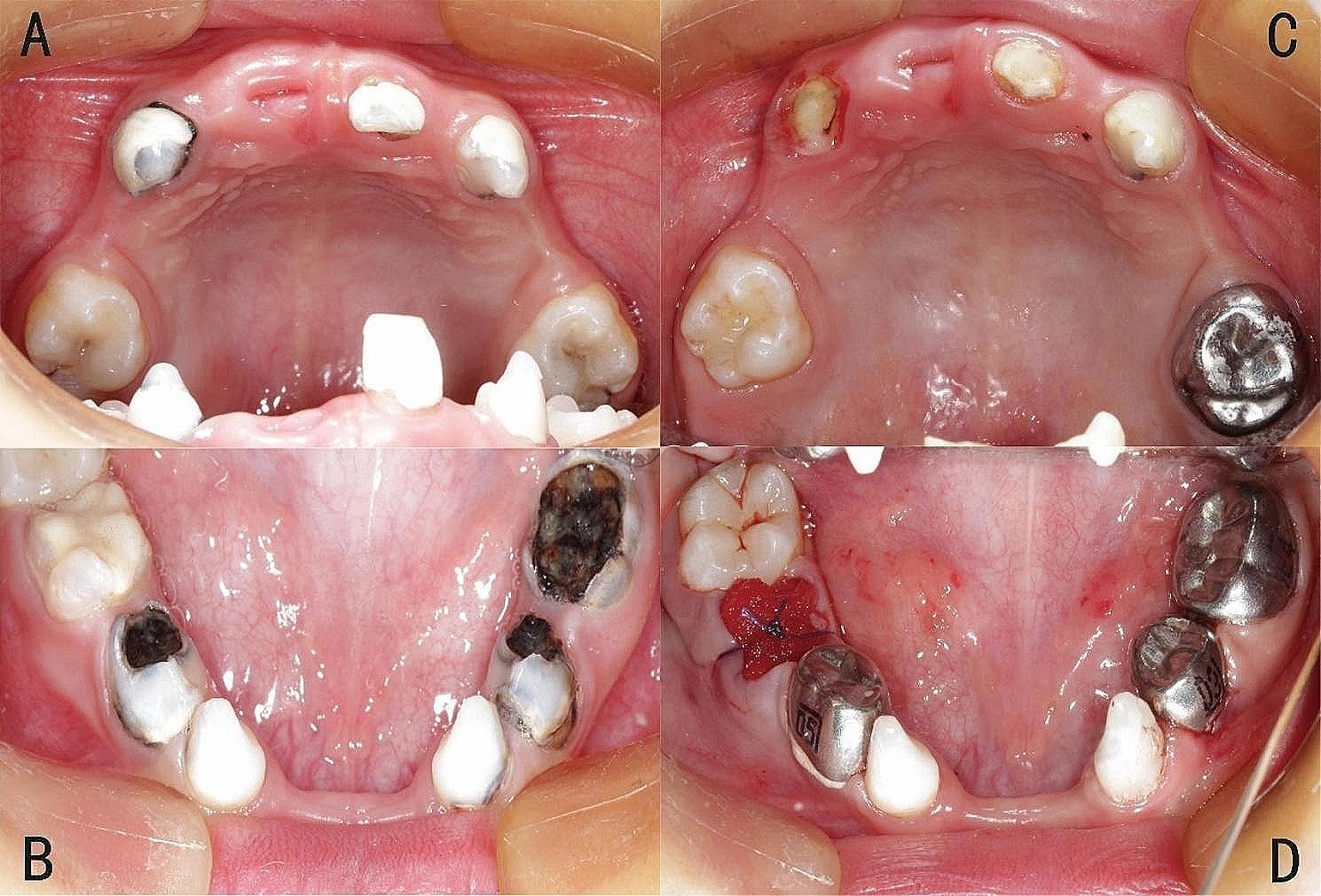 https://cdn.ncbi.nlm.nih.gov/pmc/blobs/6b7c/11270777/22b2645bb303/12903_2024_4613_Fig2_HTML.jpg