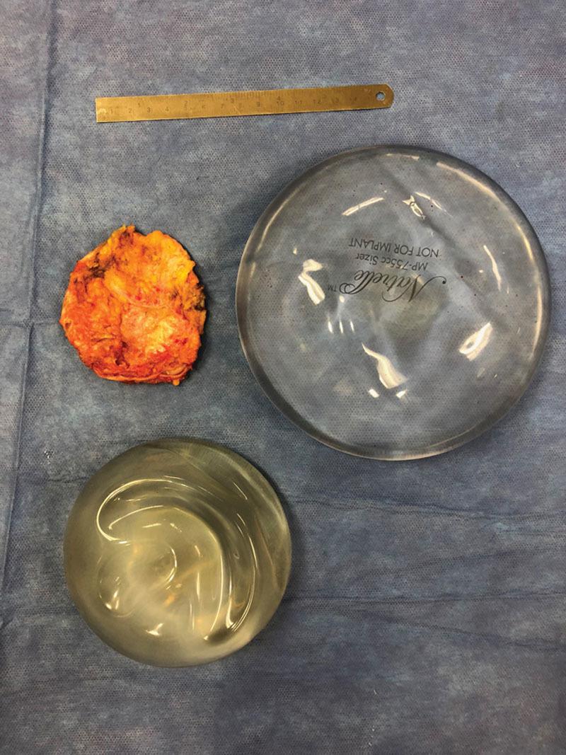 https://cdn.ncbi.nlm.nih.gov/pmc/blobs/6b7c/6467617/19a2cd58b6b9/gox-7-e2167-g002.jpg