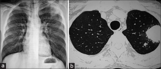 https://cdn.ncbi.nlm.nih.gov/pmc/blobs/6b80/4948227/86dfb0a325de/LI-33-398-g004.jpg