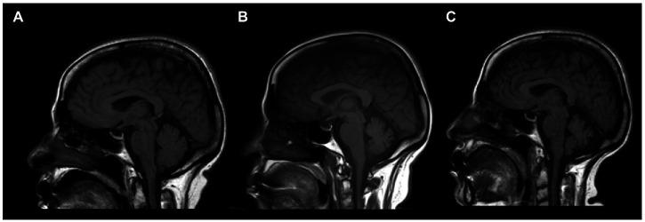 https://cdn.ncbi.nlm.nih.gov/pmc/blobs/6b85/10149714/34701cc40d22/fneur-14-1142160-g001.jpg