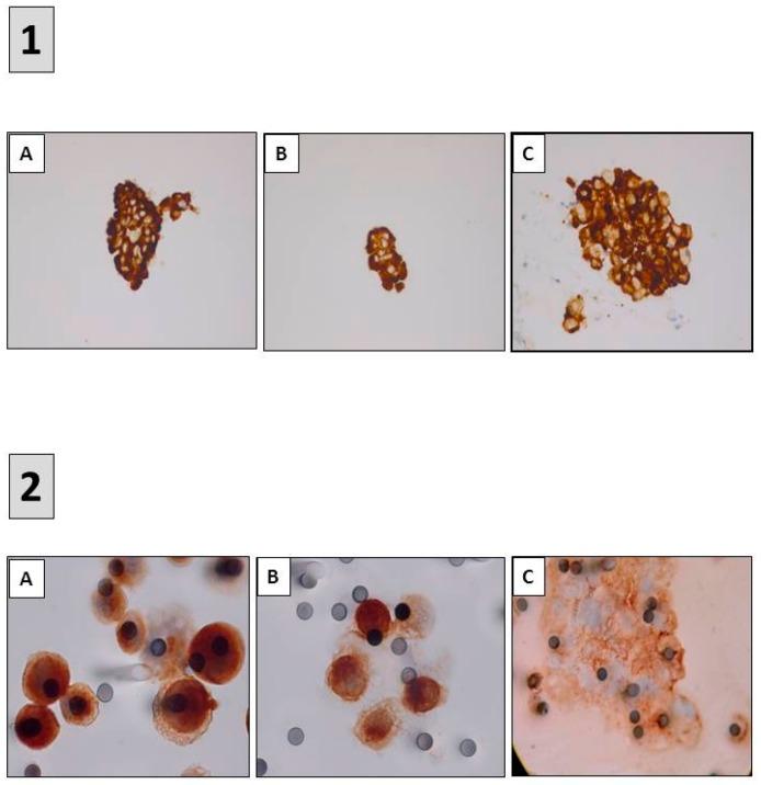 https://cdn.ncbi.nlm.nih.gov/pmc/blobs/6b8c/5876645/4404879cb53e/cancers-10-00070-g005.jpg