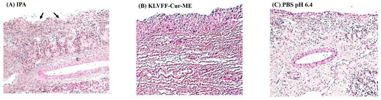 https://cdn.ncbi.nlm.nih.gov/pmc/blobs/6b90/8838555/46c8c0929bd7/polymers-14-00443-g008.jpg