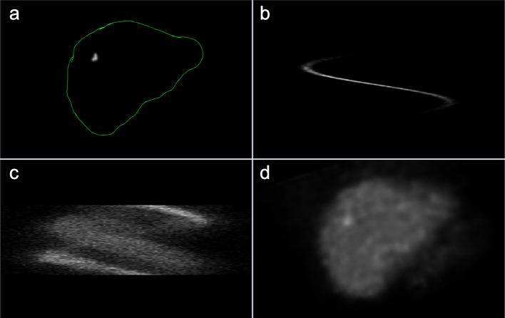 https://cdn.ncbi.nlm.nih.gov/pmc/blobs/6b91/10238363/c03bdf567956/40658_2023_557_Fig1_HTML.jpg