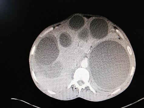 https://cdn.ncbi.nlm.nih.gov/pmc/blobs/6b97/7588311/1a432e3e7d96/rjaa438f1.jpg