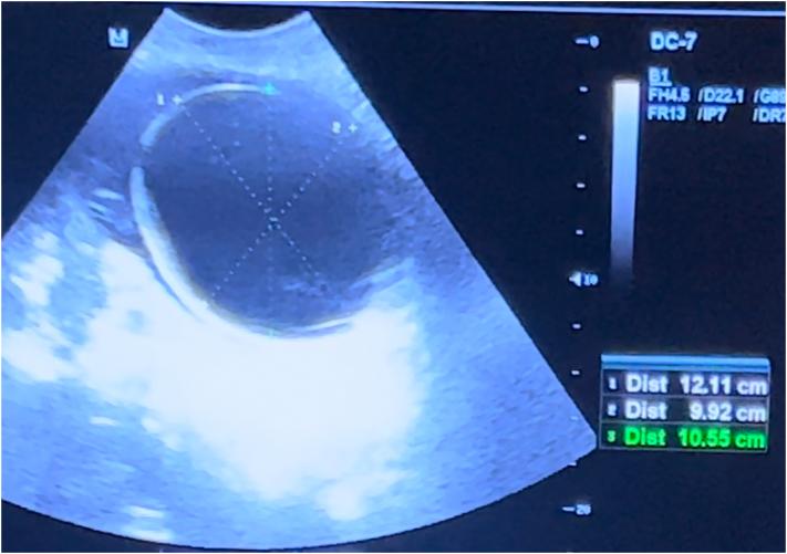 https://cdn.ncbi.nlm.nih.gov/pmc/blobs/6b97/9579800/91831c7ebe13/gr2.jpg