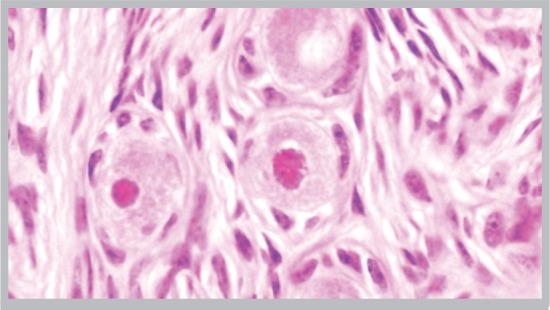 https://cdn.ncbi.nlm.nih.gov/pmc/blobs/6b9f/9237917/ec6b0a470cf2/jbra-18-01-0012-g01.jpg