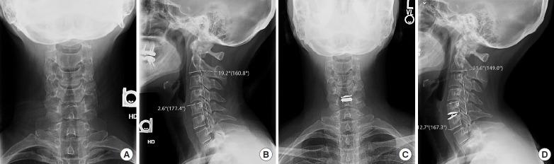 https://cdn.ncbi.nlm.nih.gov/pmc/blobs/6ba4/7538348/3af1530809ad/ns-2040398-199f3.jpg