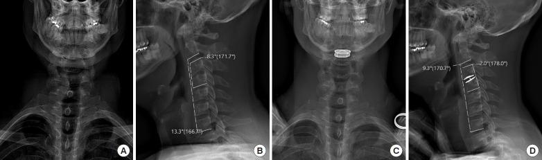https://cdn.ncbi.nlm.nih.gov/pmc/blobs/6ba4/7538348/8e6d81667c40/ns-2040398-199f5.jpg