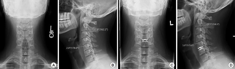 https://cdn.ncbi.nlm.nih.gov/pmc/blobs/6ba4/7538348/d5d7034c86d3/ns-2040398-199f4.jpg