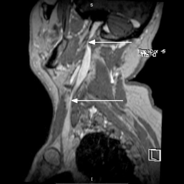 https://cdn.ncbi.nlm.nih.gov/pmc/blobs/6bb3/4049975/71386bcb5dc3/poljradiol-79-131-g003.jpg