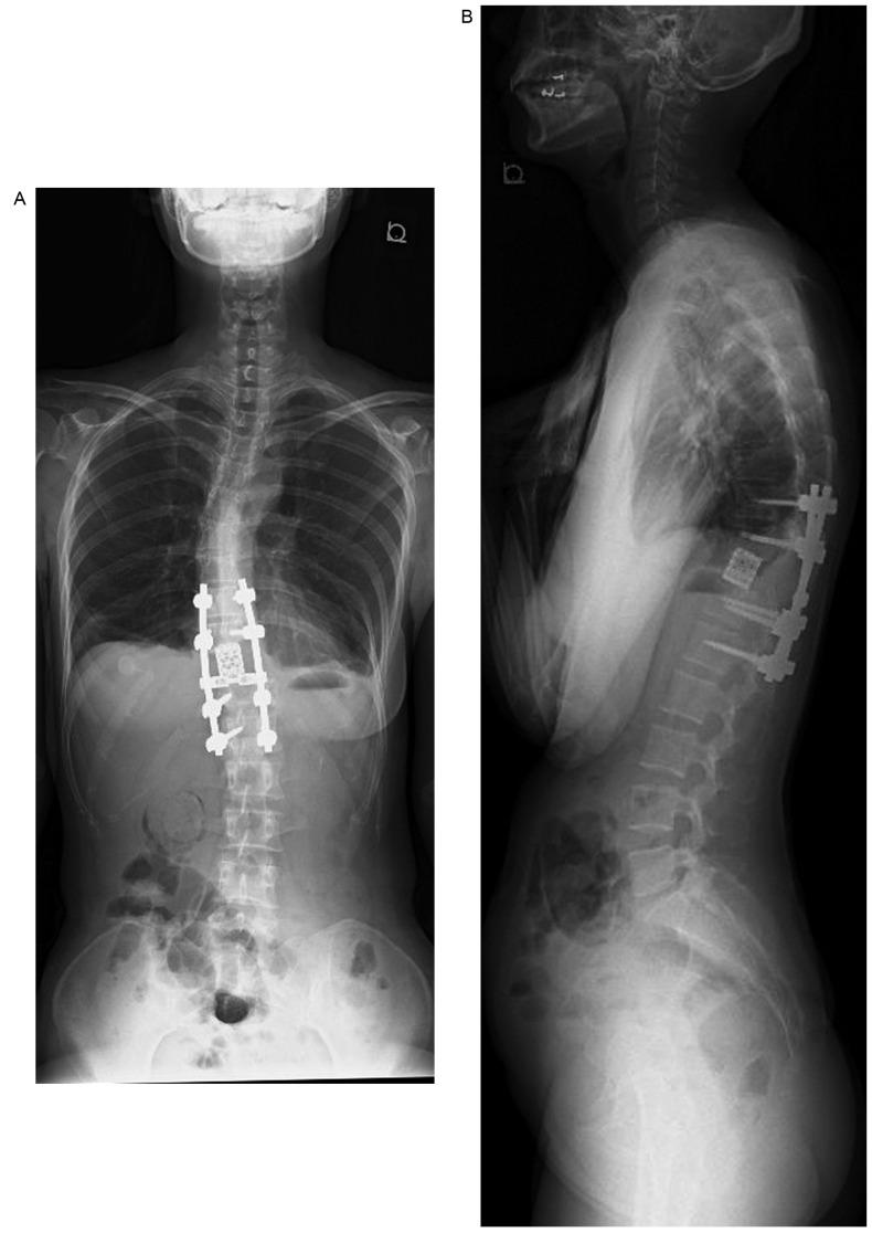 https://cdn.ncbi.nlm.nih.gov/pmc/blobs/6bb3/5592882/5747709f4890/ol-14-04-4005-g08.jpg