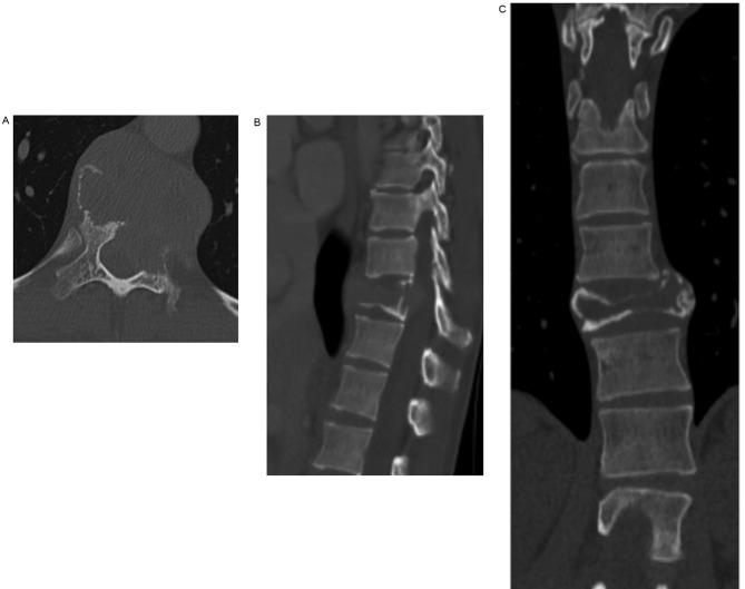 https://cdn.ncbi.nlm.nih.gov/pmc/blobs/6bb3/5592882/9952486bf07e/ol-14-04-4005-g01.jpg