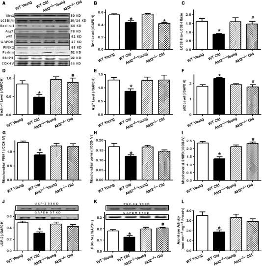 https://cdn.ncbi.nlm.nih.gov/pmc/blobs/6bbe/5595687/43876681b389/ACEL-16-976-g004.jpg