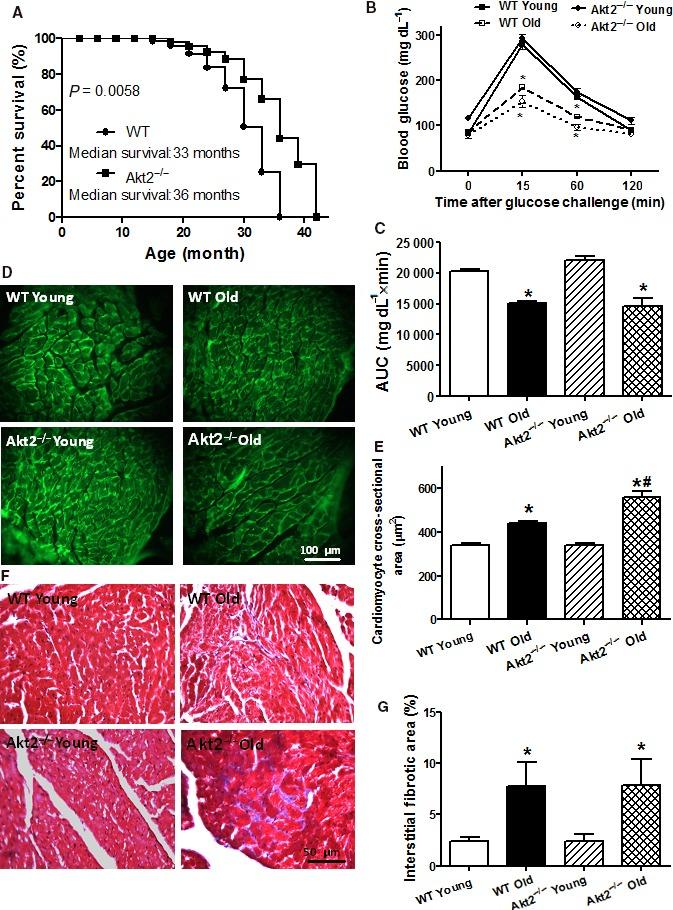 https://cdn.ncbi.nlm.nih.gov/pmc/blobs/6bbe/5595687/6010d5a4a4b2/ACEL-16-976-g001.jpg