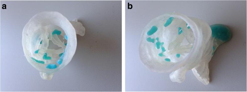 https://cdn.ncbi.nlm.nih.gov/pmc/blobs/6bbf/6377684/63247709fd97/41747_2018_83_Fig4_HTML.jpg