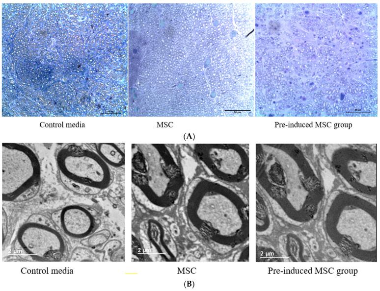 https://cdn.ncbi.nlm.nih.gov/pmc/blobs/6bc8/9318960/edc468eb1ae5/ijms-23-07638-g008a.jpg