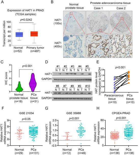 https://cdn.ncbi.nlm.nih.gov/pmc/blobs/6bc9/8299045/536b89a2757f/CTM2-11-e495-g003.jpg