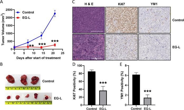 https://cdn.ncbi.nlm.nih.gov/pmc/blobs/6bd4/6895165/5d9e335f1cb3/41698_2019_105_Fig5_HTML.jpg