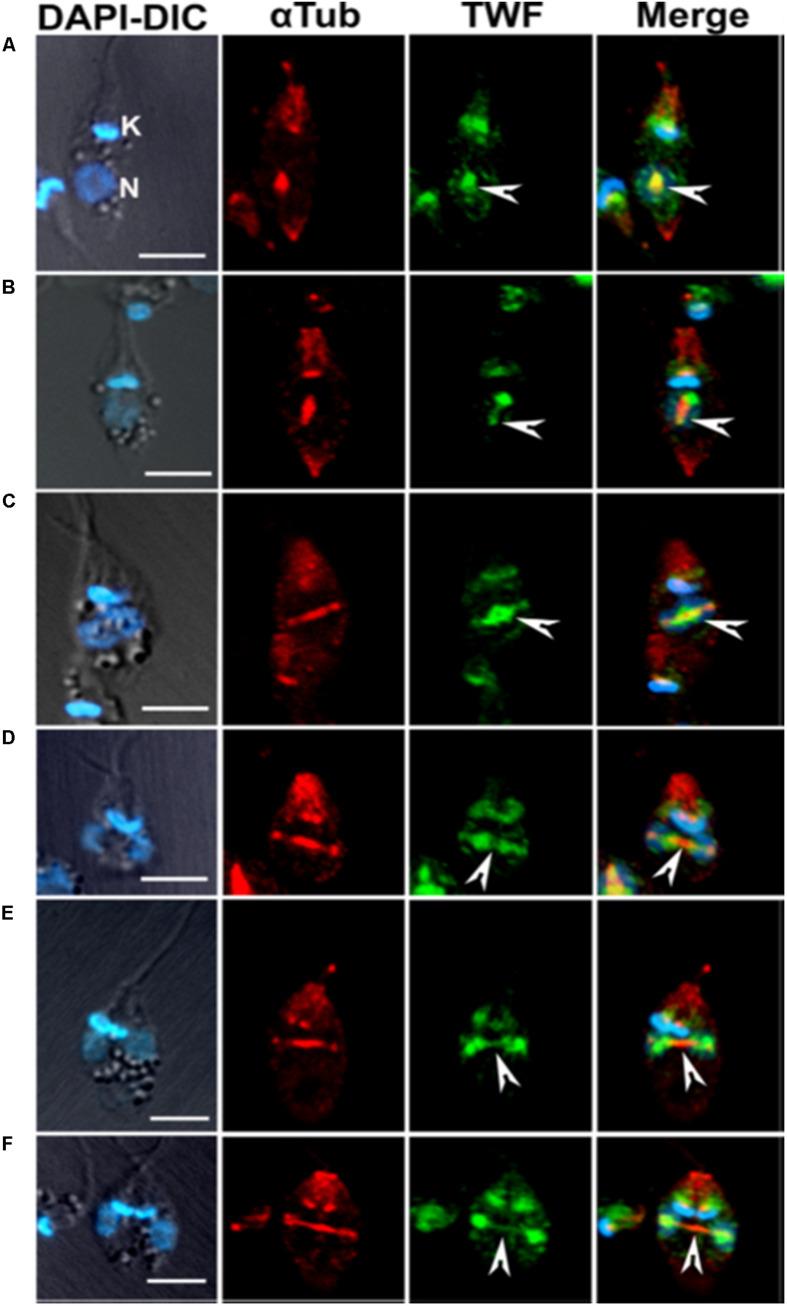 https://cdn.ncbi.nlm.nih.gov/pmc/blobs/6be3/7581878/2d3fa9e13d91/fcell-08-587685-g009.jpg