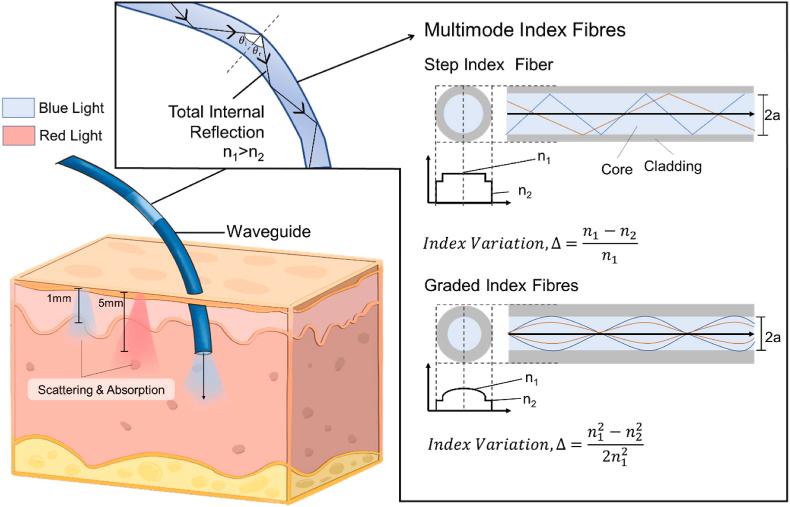 https://cdn.ncbi.nlm.nih.gov/pmc/blobs/6be4/11059474/43f4ce382c3c/gr2.jpg