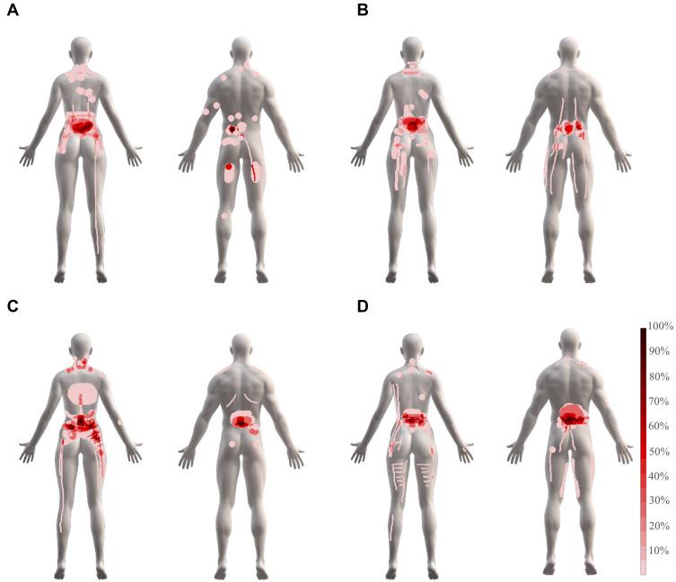 https://cdn.ncbi.nlm.nih.gov/pmc/blobs/6be9/7901430/c916ddd01183/JPR-14-487-g0002.jpg