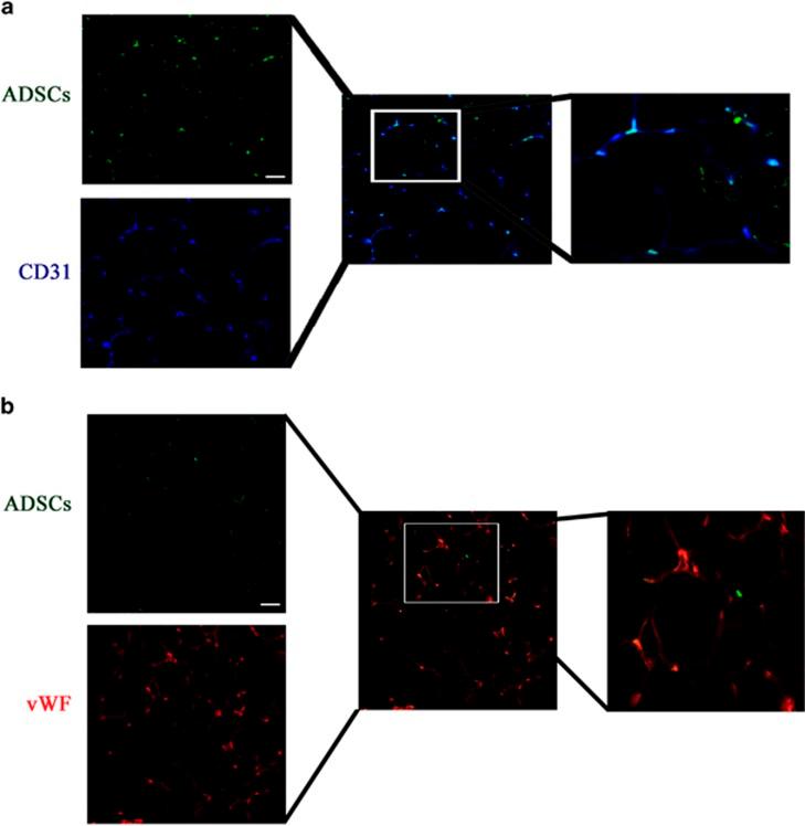 https://cdn.ncbi.nlm.nih.gov/pmc/blobs/6bef/5059864/a8d165b51796/cddis2016261f3.jpg