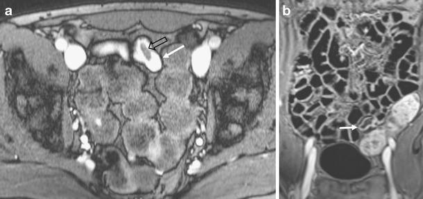 https://cdn.ncbi.nlm.nih.gov/pmc/blobs/6bf6/3289029/2e54de9e98fa/13244_2011_115_Fig4_HTML.jpg
