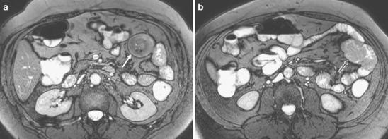 https://cdn.ncbi.nlm.nih.gov/pmc/blobs/6bf6/3289029/31987d666985/13244_2011_115_Fig7_HTML.jpg
