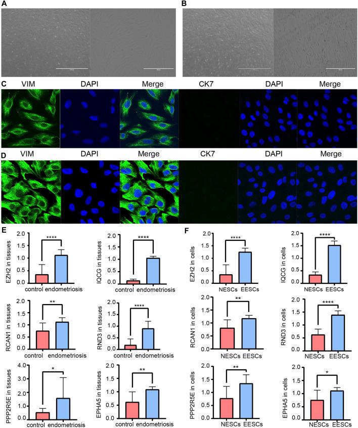 https://cdn.ncbi.nlm.nih.gov/pmc/blobs/6bf6/8591037/d7801b9699ba/fmolb-08-743012-g007.jpg