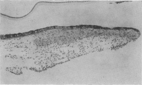 https://cdn.ncbi.nlm.nih.gov/pmc/blobs/6bf9/1897003/b1f952b5fc85/procrsmed00225-0038-a.jpg