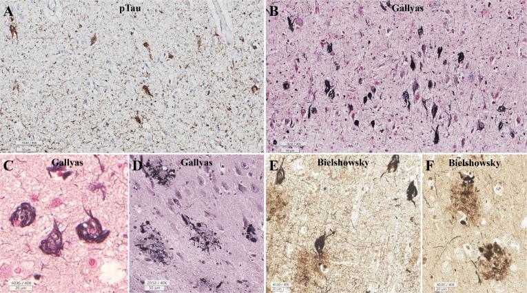 https://cdn.ncbi.nlm.nih.gov/pmc/blobs/6bfa/11738475/e93e97d56a19/en-33-6-295-f4.jpg