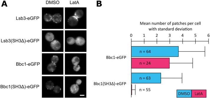https://cdn.ncbi.nlm.nih.gov/pmc/blobs/6bfc/10011730/9033a0e9cfc2/mbc-34-ar19-g005.jpg