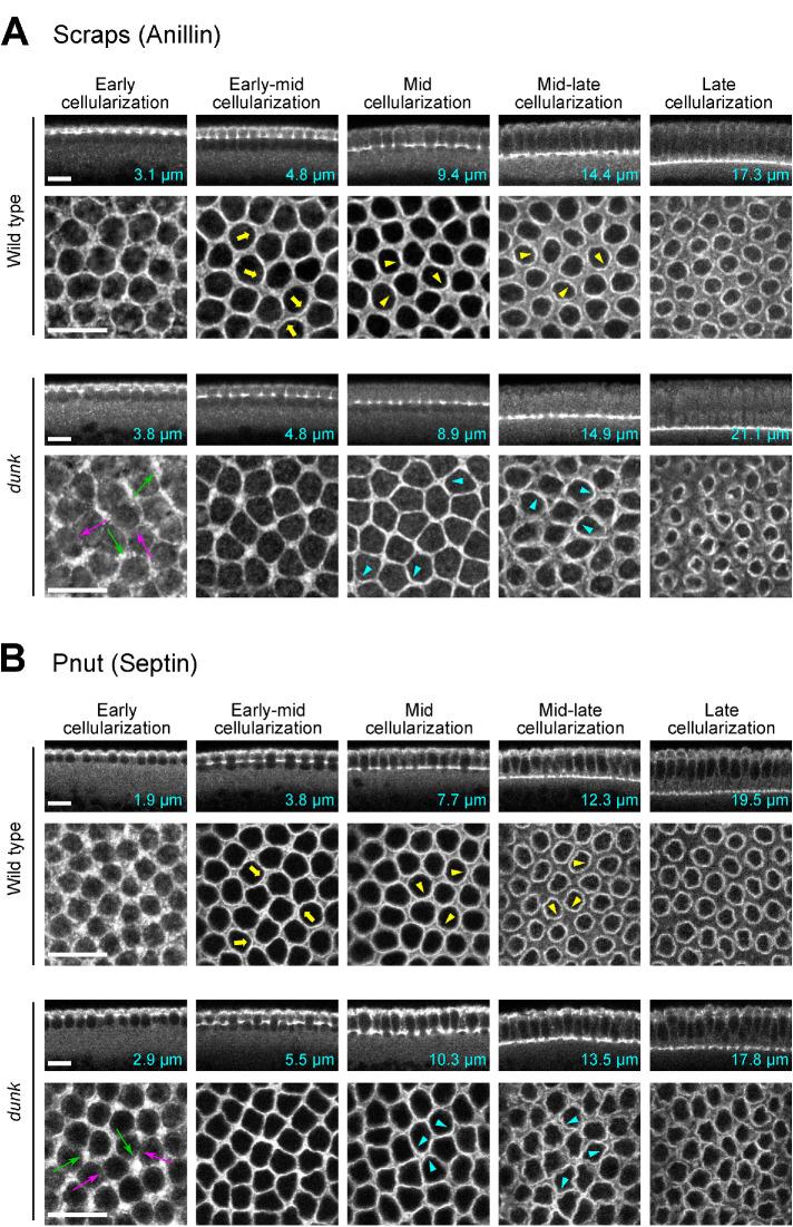 https://cdn.ncbi.nlm.nih.gov/pmc/blobs/6bfc/10551699/86aef6333055/mbc-34-ar102-g003.jpg